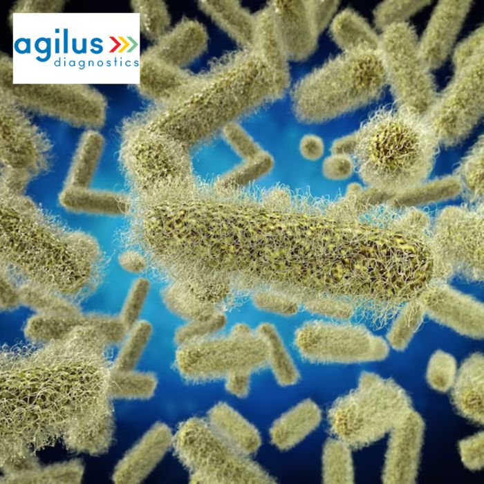 Agilus Diagnostics