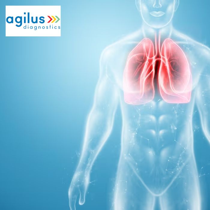 Agilus Diagnostics