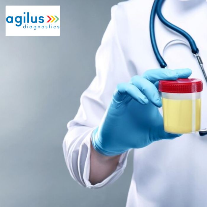Agilus Diagnostics