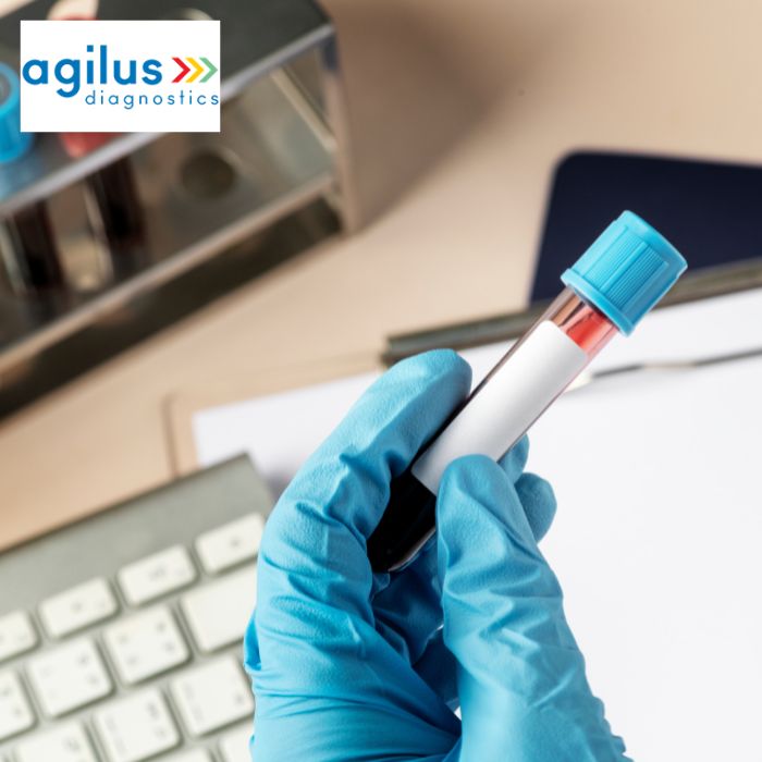 Agilus Diagnostics