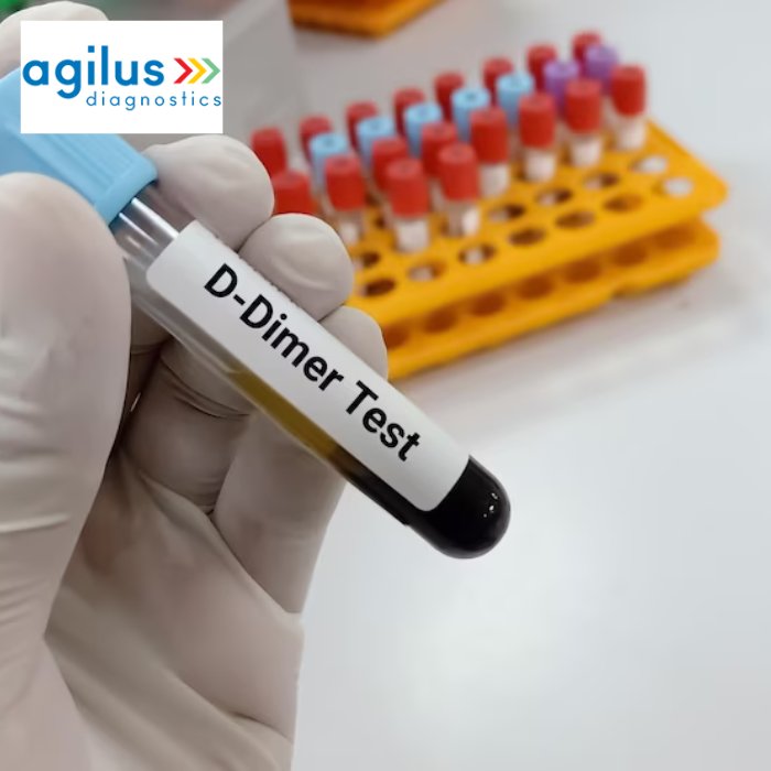 Agilus Diagnostics