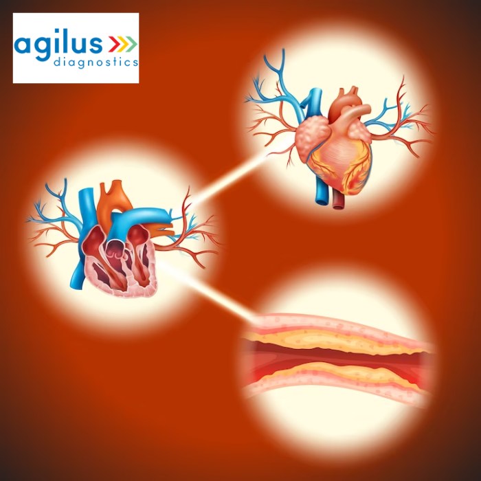 Agilus Diagnostics