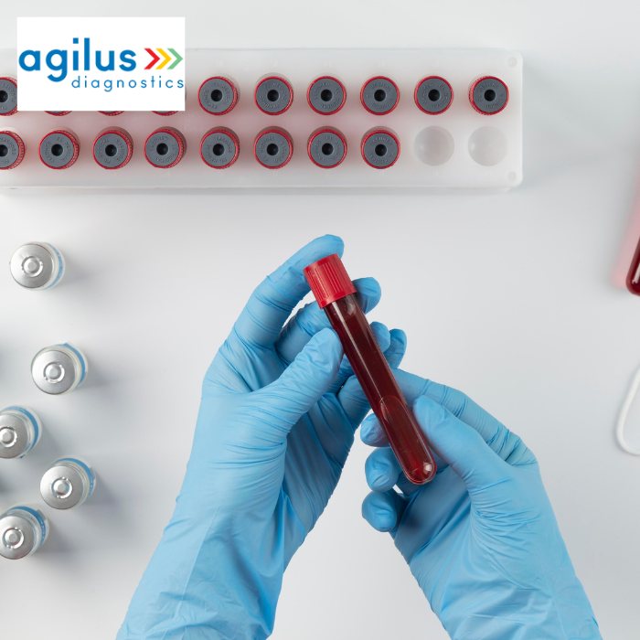 Agilus Diagnostics