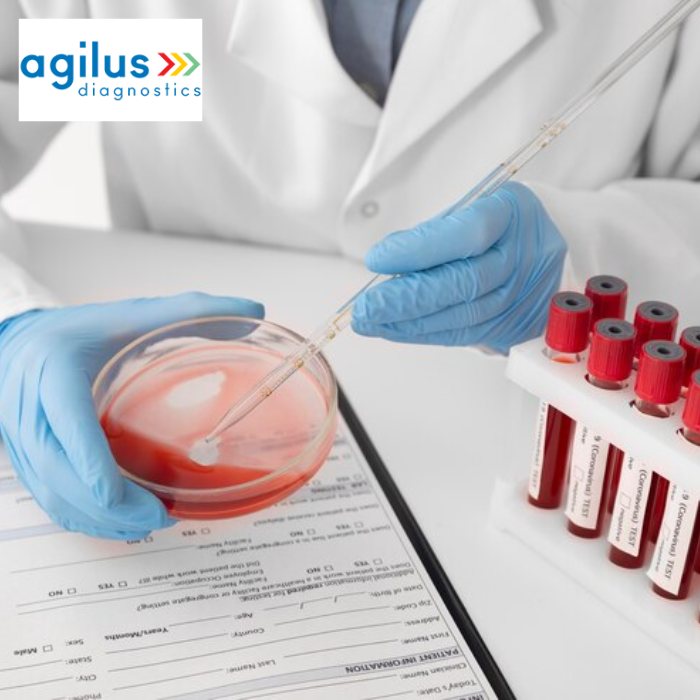 agilus-diagnostics