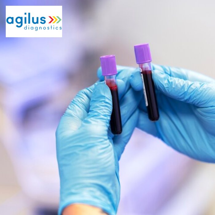Agilus Diagnostics