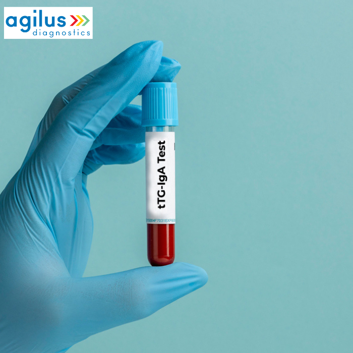 Agilus Diagnostics